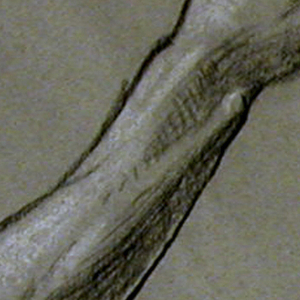 Drawing, detail of an arm, ca. 1885