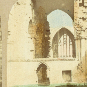Stereograph