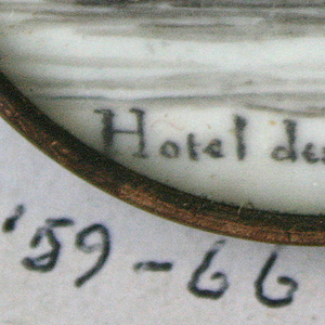 Button